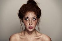 Freckled girl