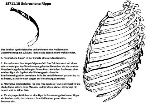 Gebroken rib 18711.10