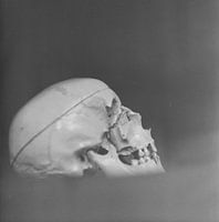 Totenkopf