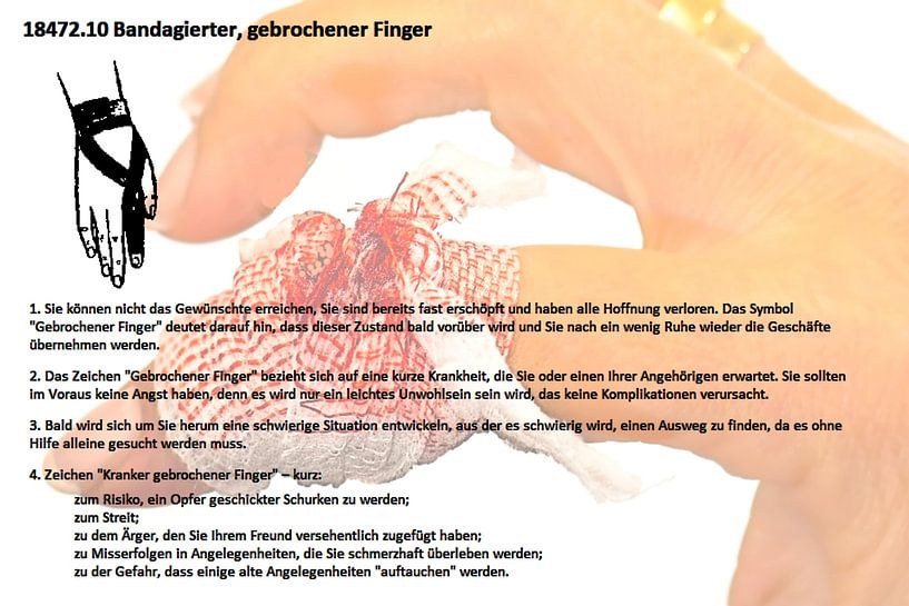 Doigt bandé et cassé 18472.10 par Vladimir Zykunov