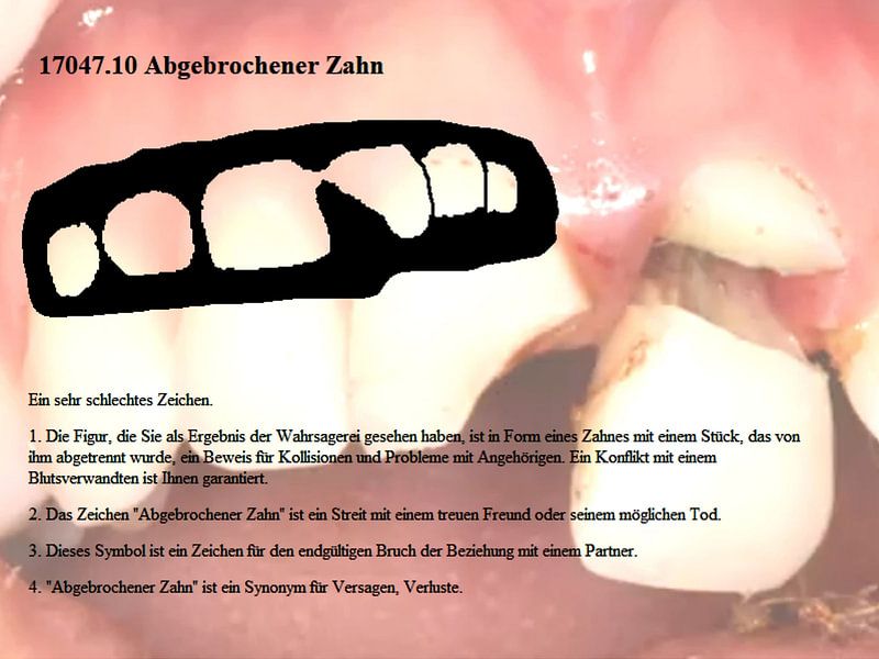Gebroken tand 17047.10 van Vladimir Zykunov