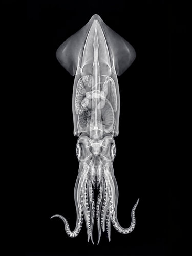 Squid X-ray