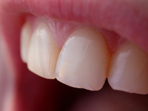 Smile :), stefan witte