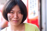 Portret van Chinese vrouw met litteken