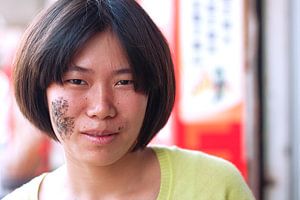 Portret van Chinese vrouw met litteken