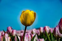 Tulpen