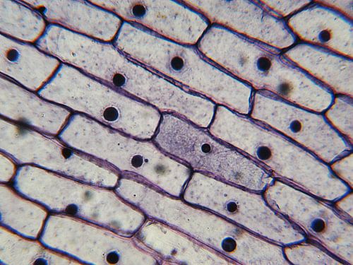 Rinde einer Zwiebel unter dem Mikroskop