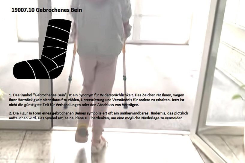 Gebrochenes Bein 19007.10 von Vladimir Zykunov