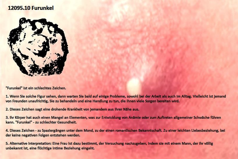 Furoncle 12095.10 par Vladimir Zykunov