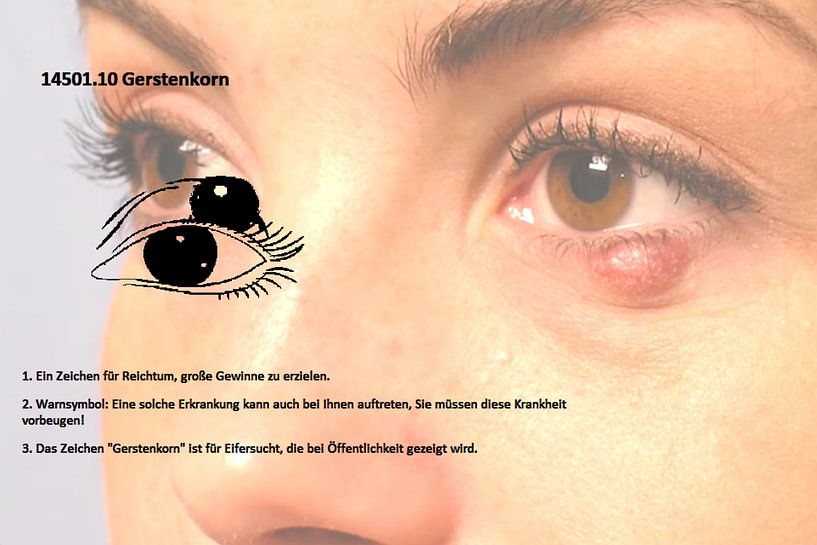 Grain d'orge 14501.10 par Vladimir Zykunov