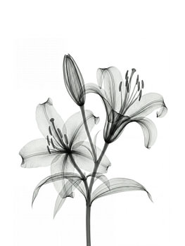 Radiographie florale
