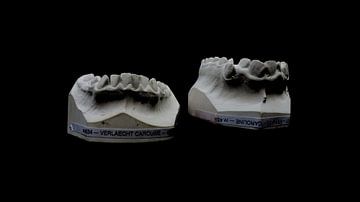 monstrous teeth by colinear ammit