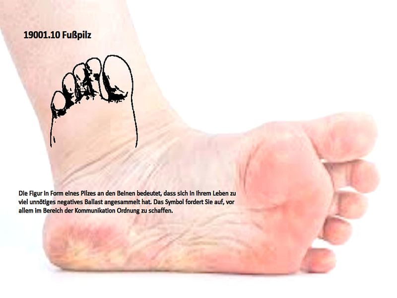 Mycose du pied 19001.10 par Vladimir Zykunov