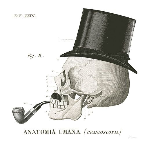 Dandy Bones II, Sue Schlabach