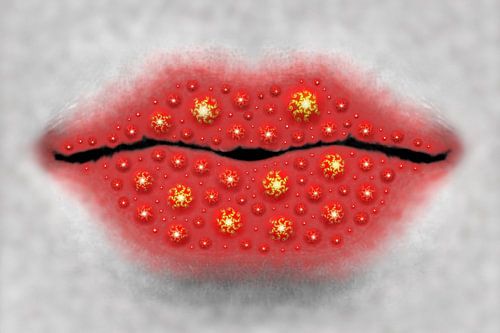 WEIRD COLD SORE IN BLOOM