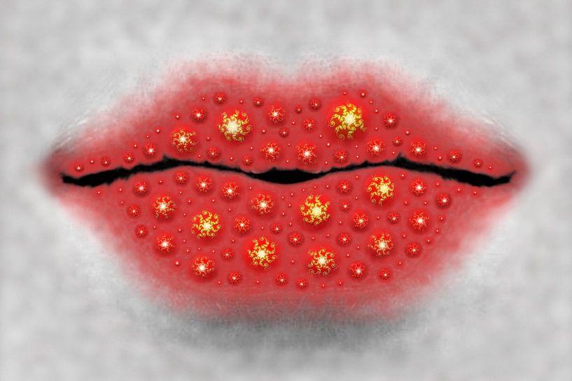 WEIRD COLD SORE IN BLOOM von Elwe