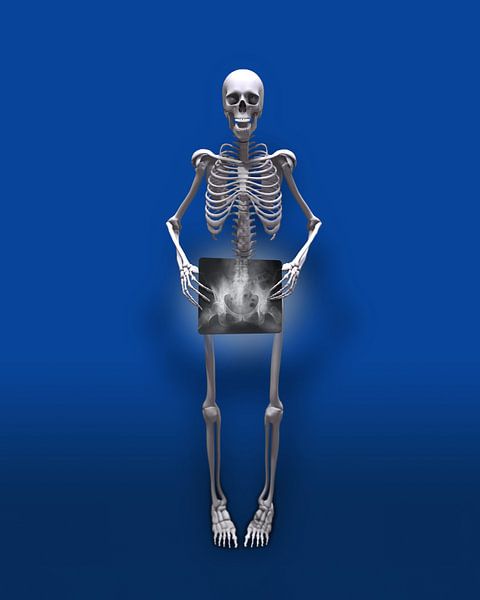 Bijna naakt Skelet van Peter Hermus