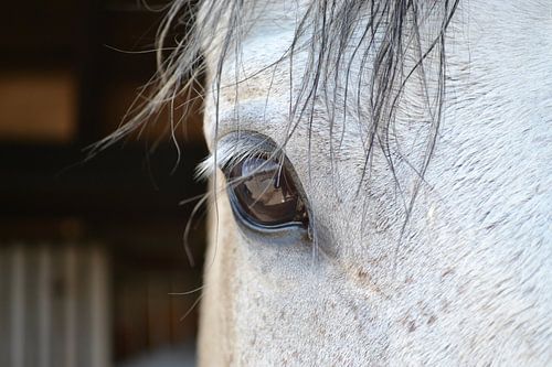 Eye