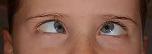 Junge, der mit blauen Augen schielen schaut