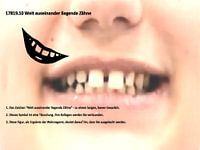 Dents très écartées 17819.10