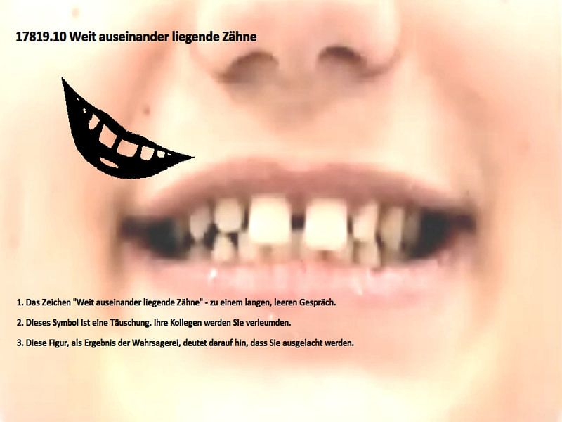 Dents très écartées 17819.10 par Vladimir Zykunov