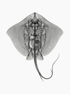 Stingray X-ray