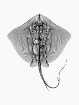 Radiographie Stingray