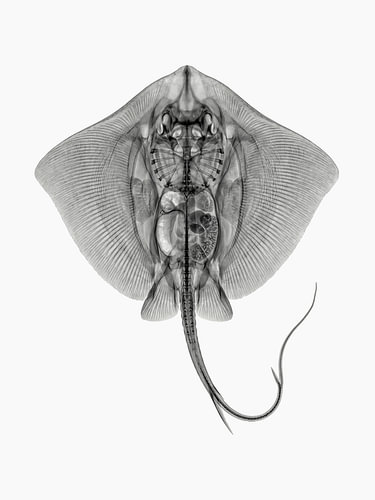 Stingray-Röntgen