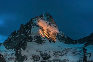 DENT BLANCHE