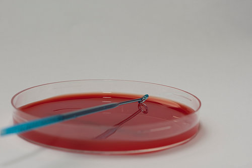 Reinstrijken van een bacterie