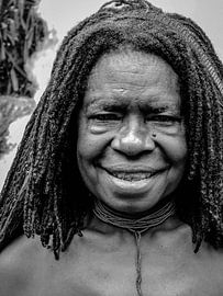 Women cut off part of a finger von Global Heartbeats