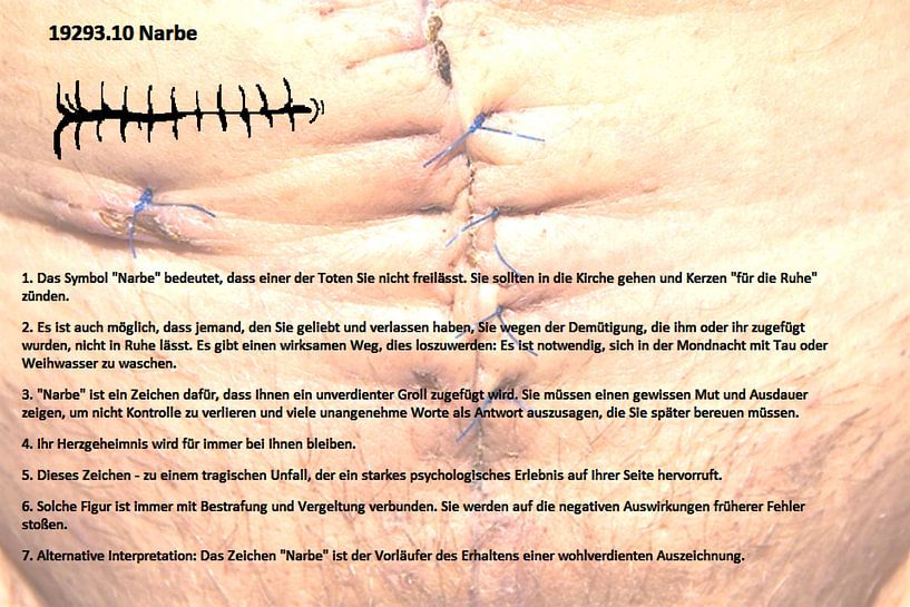 Narbe 19293.10 von Vladimir Zykunov