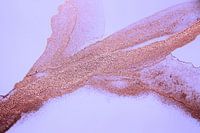 Roségold