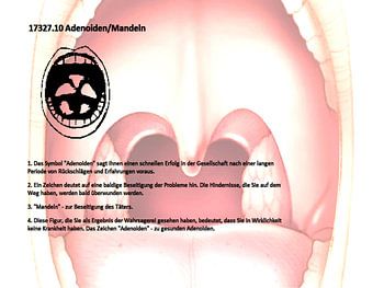Adenoids, tonsils 17327.10