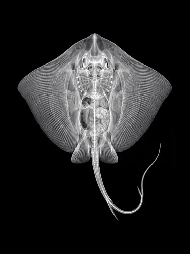 Stingray-Röntgen