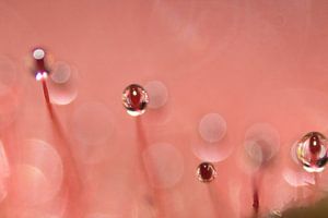 Sundew 6