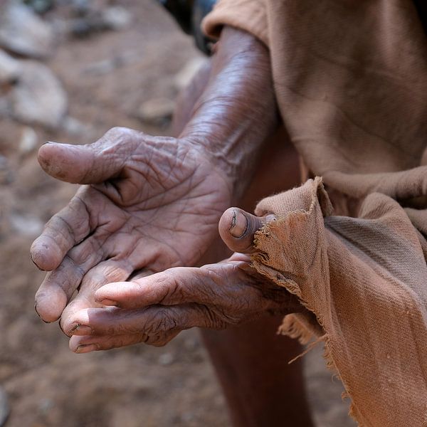 Hände mit Lebensspuren von Affect Fotografie