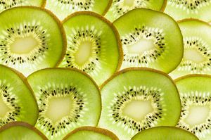 Kiwifruchtscheiben (Hintergrundbeleuchtung ) von BeeldigBeeld Food & Lifestyle