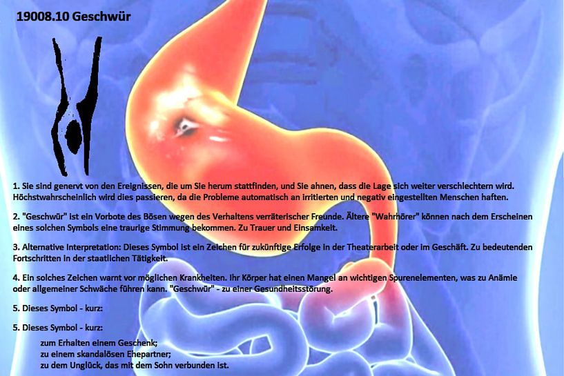 Ulcère 19008.10 par Vladimir Zykunov