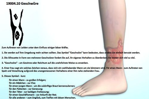 Ulcères 19004.10 sur Vladimir Zykunov