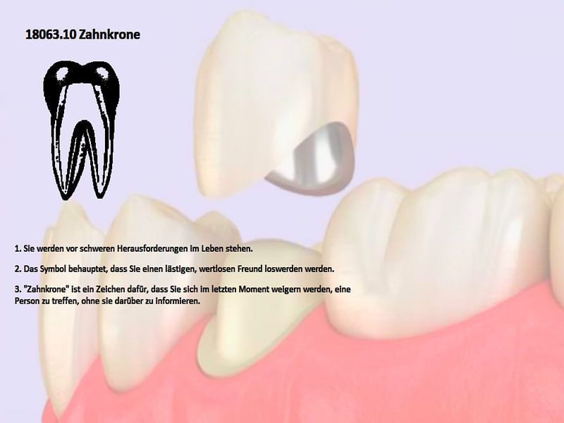 Zahnkrone 18063.10091 von Vladimir Zykunov