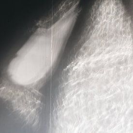 Licht op muur van Léontine Lamers