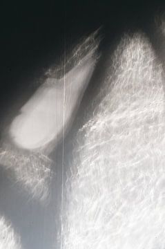 Licht op muur