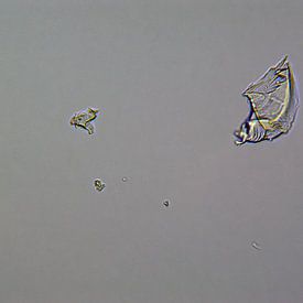 Liquid ibuprofen onder een microscoop van Wijco van Zoelen