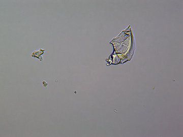 Liquid ibuprofen onder een microscoop van Wijco van Zoelen