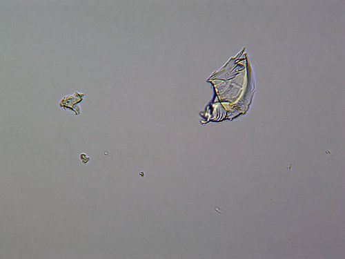 Flüssiges Ibuprofen unter dem Mikroskop