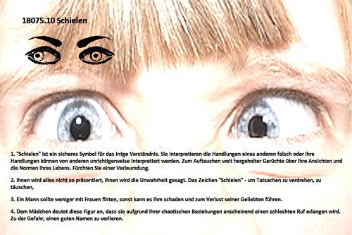 Strabisme 18075.10
