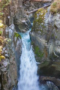 Ruetz cataract